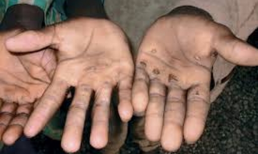 CV19  limpieza de manos